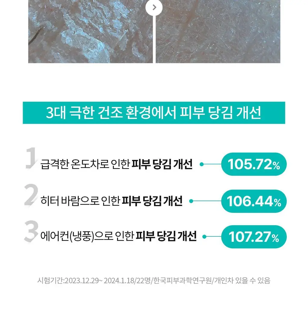 [각질개선율191%]리쥬란 더마 힐러 모이스처 트리트먼트 토너 150ml 상세페이지 14